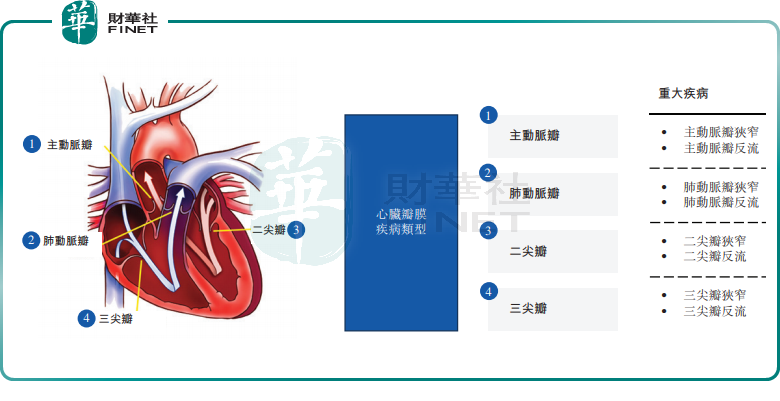 捍宇医疗：深耕心脏瓣膜病器械领域，商业化前景可期