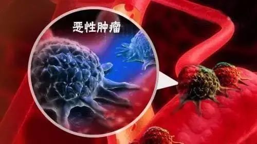 中国癌症新发和死亡人数全球第一
