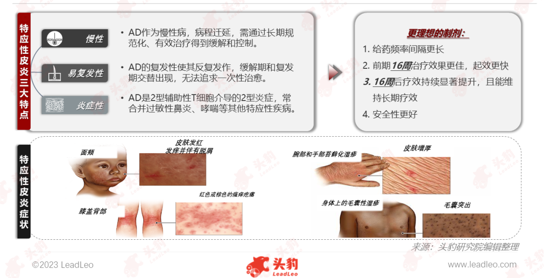 2023年AD治疗药物行业热点追踪：度普利尤之后，新一代AD治疗生物制剂前瞻