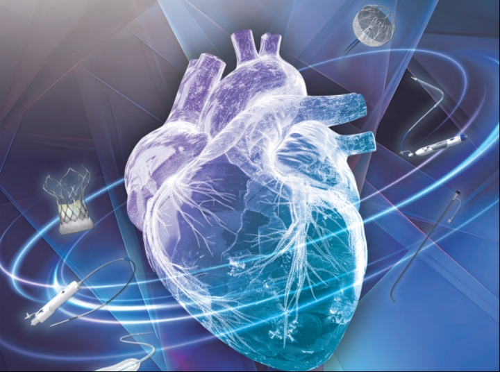 微创心通股价飙升逾14%，有何利好？